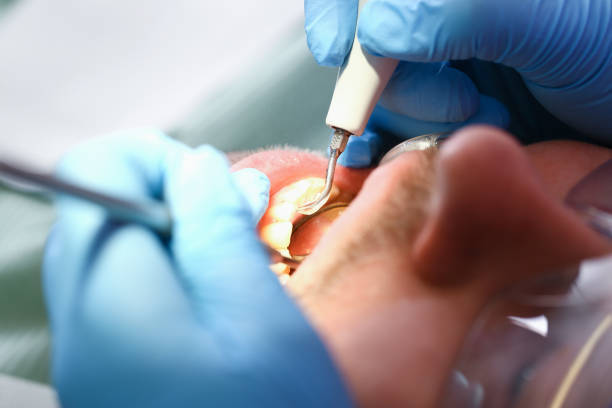 Urgent Tooth Repair in TN