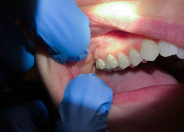 Best Teeth Whitening  in New Tazewell, TN