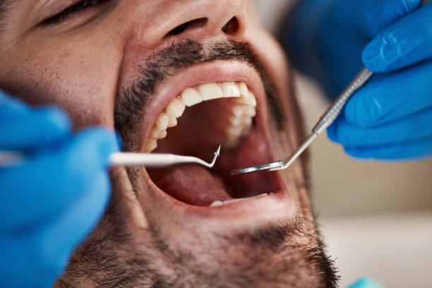 Best Chipped Tooth Repair Near Me  in New Tazewell, TN