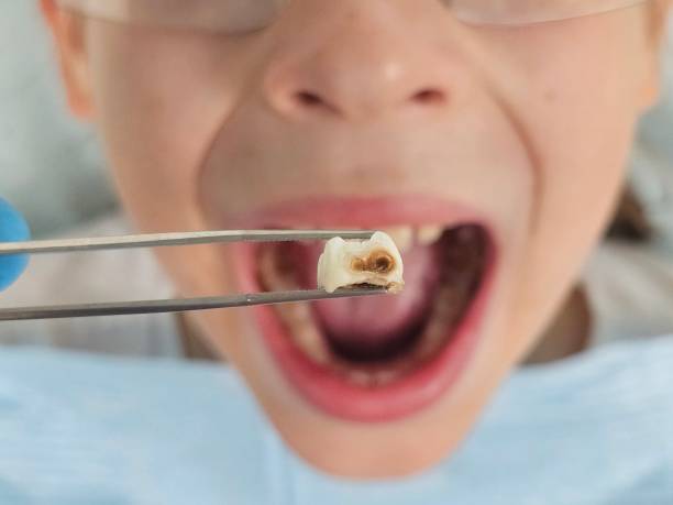Best Cracked Tooth Emergency Dentist  in New Tazewell, TN